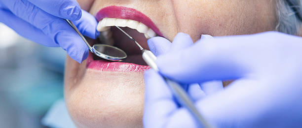 Best Emergency Dental Care for Broken or Chipped Teeth in Dalton, OH